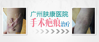 广州肤康皮肤病医院